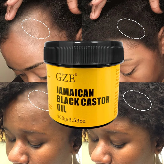 GZE Óleo de Rícino Preto Jamaicano Puro Prensado a Frio para Crescimento do Cabelo, Hidratação da Pele e Saúde do Couro Cabeludo